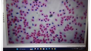 widok komórek pod mikroskopem